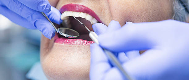 Best Knocked-Out Tooth (Avulsed Tooth) Treatment in New Eagle, PA